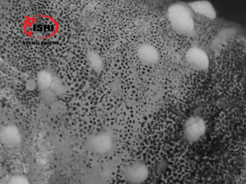 Ký sinh trùng đốm trắng White Spot soi dưới kính hiển ví